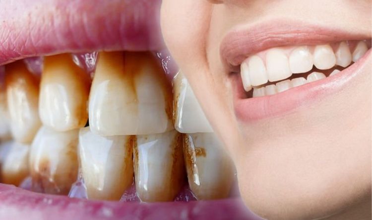 how to remove brown stains from teeth naturally