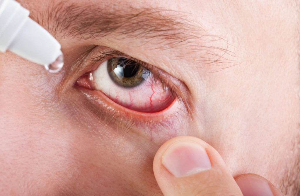 can you use contact solution as eye drops