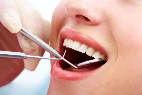 Tooth Extraction