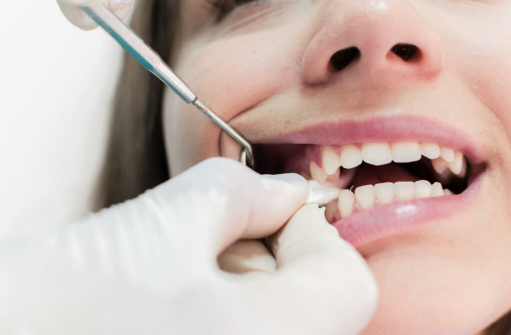 how long to keep gauze in after tooth extraction