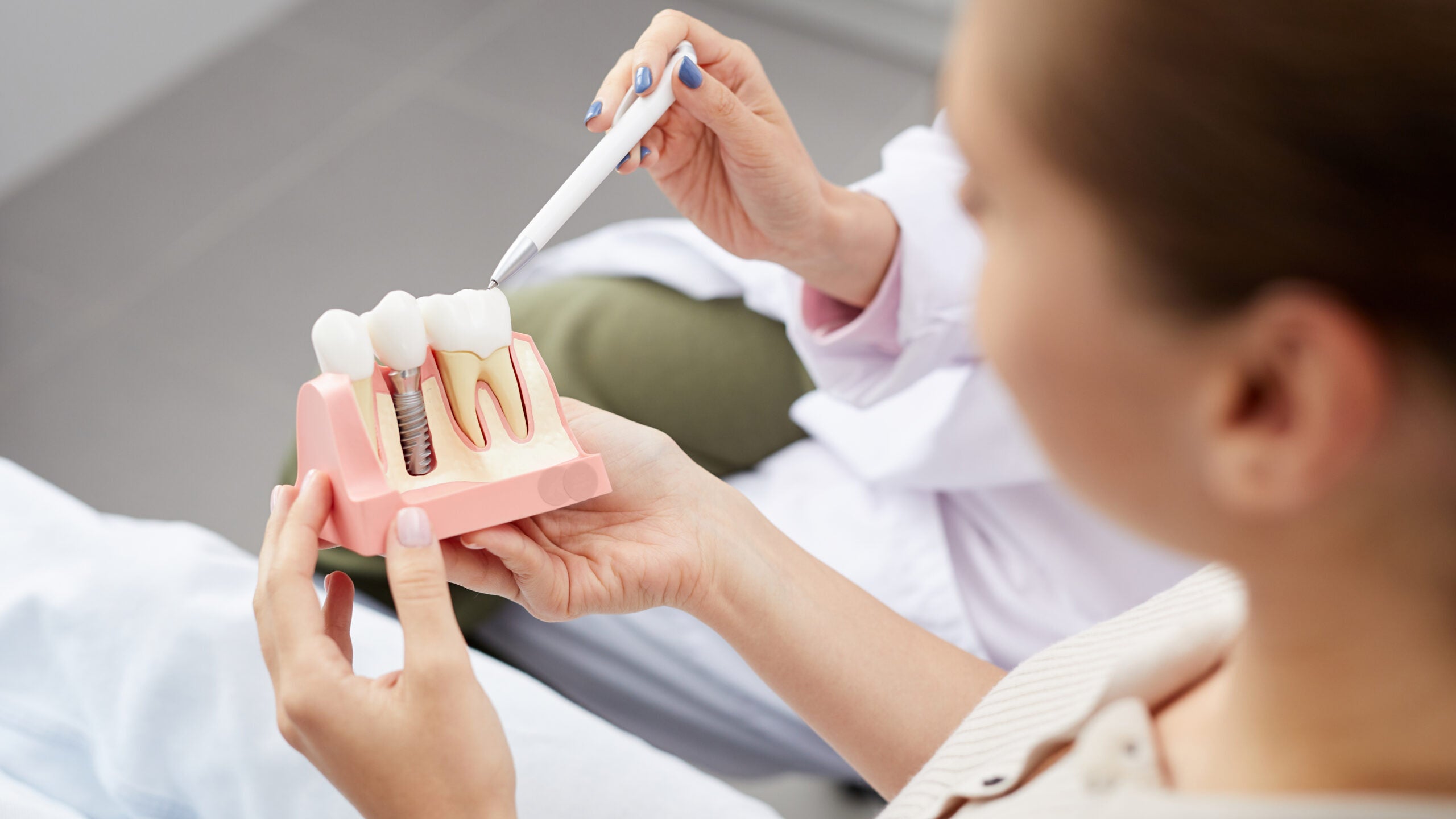 how to get dental implants covered by medical insurance