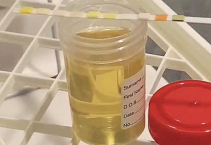 can blood in urine go away on its own