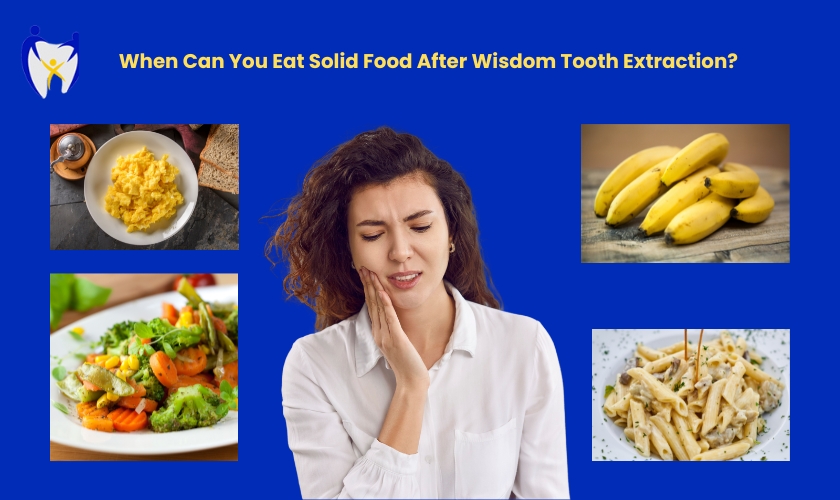 when can i eat after wisdom teeth removal