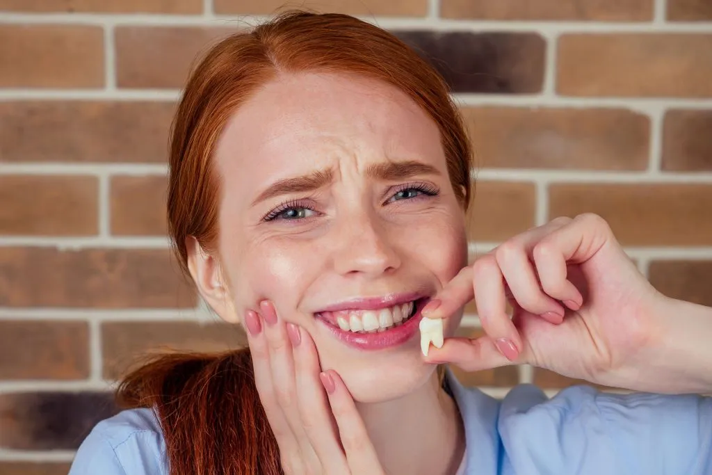 face shape before and after wisdom teeth removal